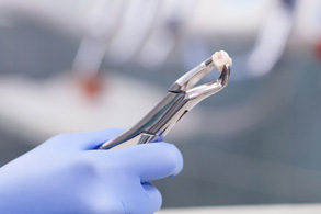 Hands holding forceps after tooth extraction in Salinas, CA
