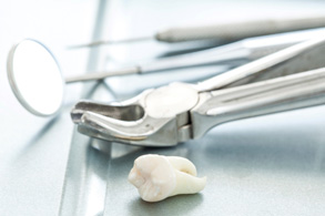 Tooth lying next to dental instruments after tooth extraction in Salinas, CA