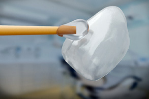 A closeup of a dental veneer and applicator