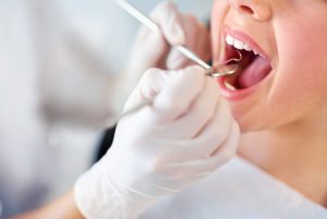 Your Salinas, CA dentist, Dr. Gary Klugman, tells how cavities form and how to treat and prevent them. Read about this important oral health topic.