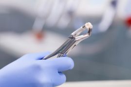 Dentist holding an extracted tooth