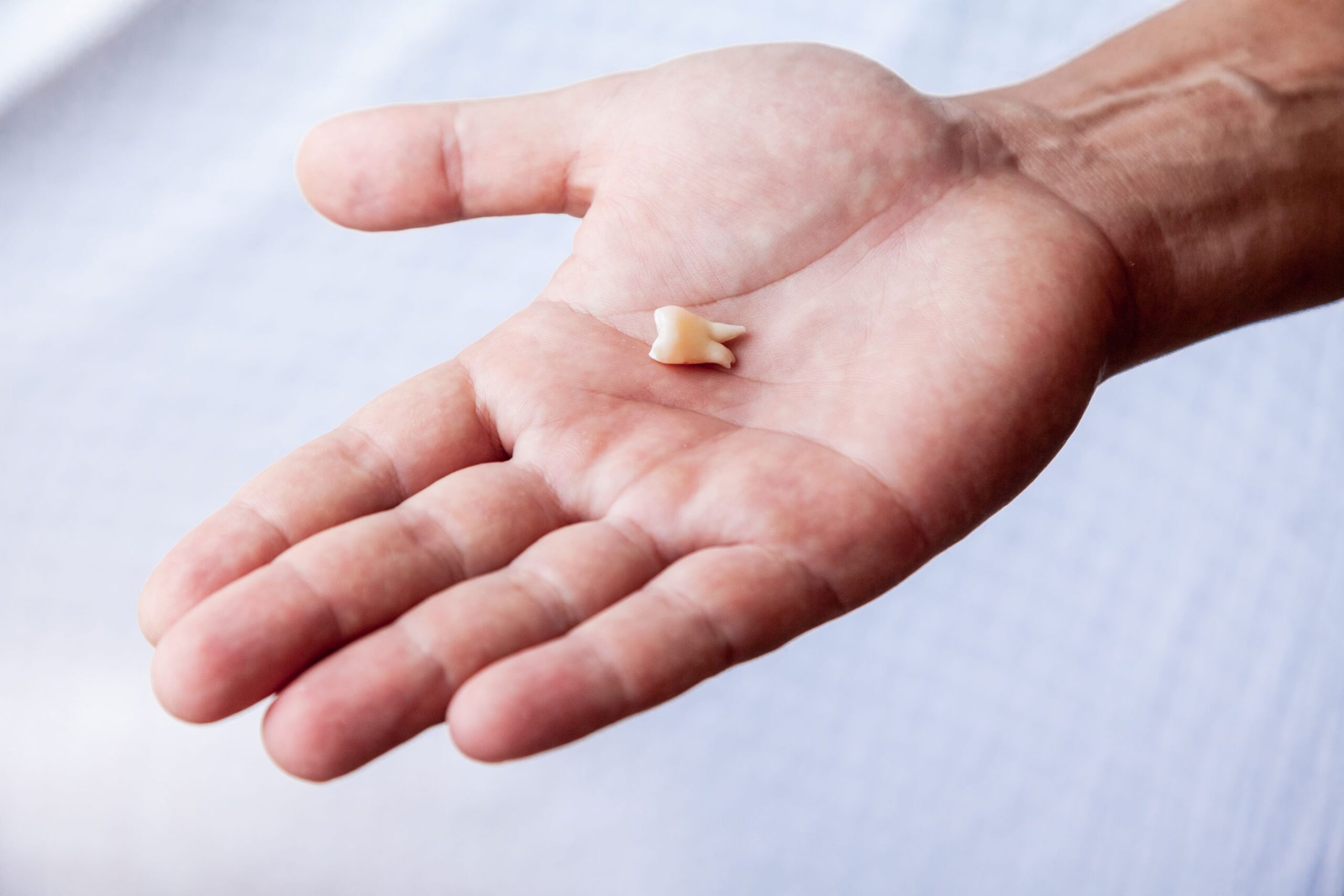 Dental Dilemma: How to Handle a Lost Permanent Tooth | Blanco Circle ...